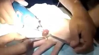 Cincin